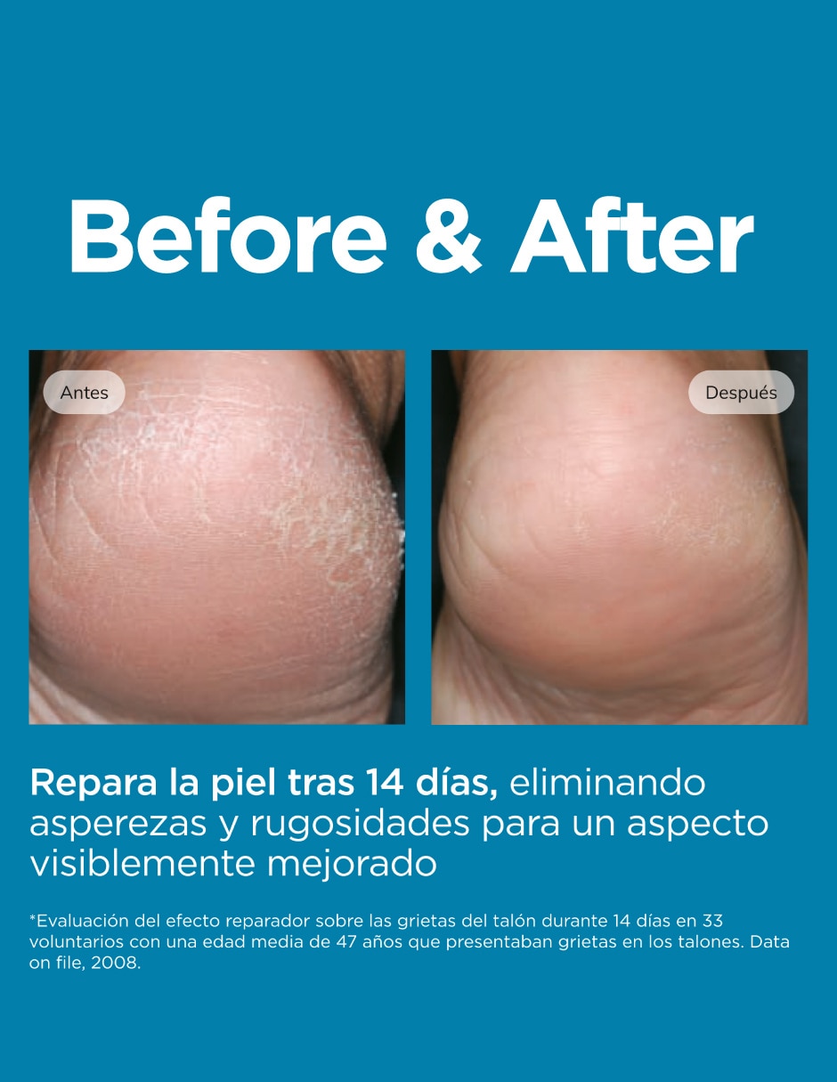 Crema para pies recomendada para hidratar Ureadin para piel seca 6
