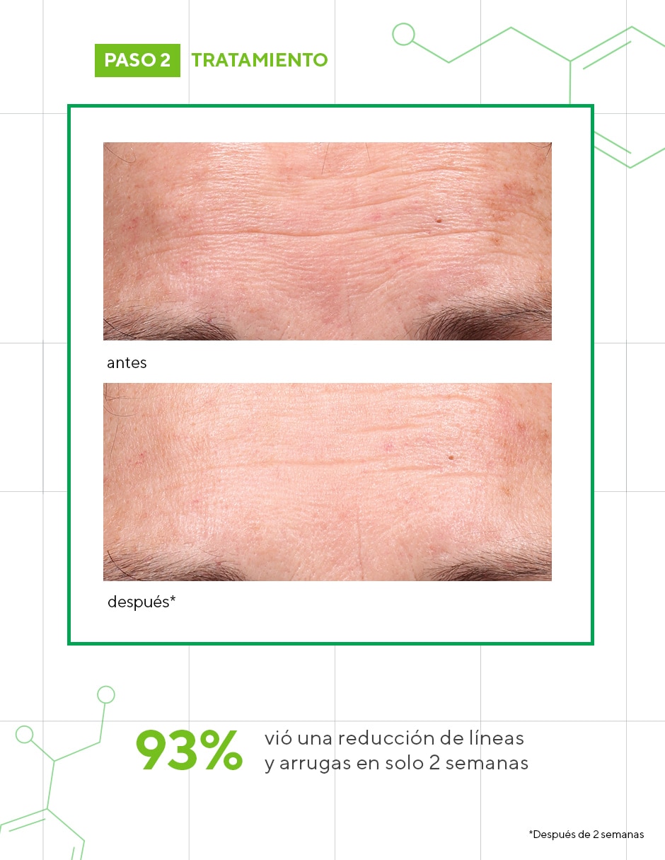 Sérum de retinol facial Retinol Youth Renewal todo tipo piel Sérum de retinol facial Retinol Youth Renewal todo tipo piel