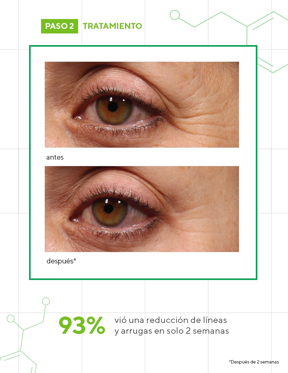 Crema para contorno de ojos recomendada para prevenir signos de la edad de noche Retinol Youth Renewal Resurgence todo tipo piel Crema para contorno de ojos recomendada para prevenir signos de la edad de noche Retinol Youth Renewal Resurgence todo tipo piel