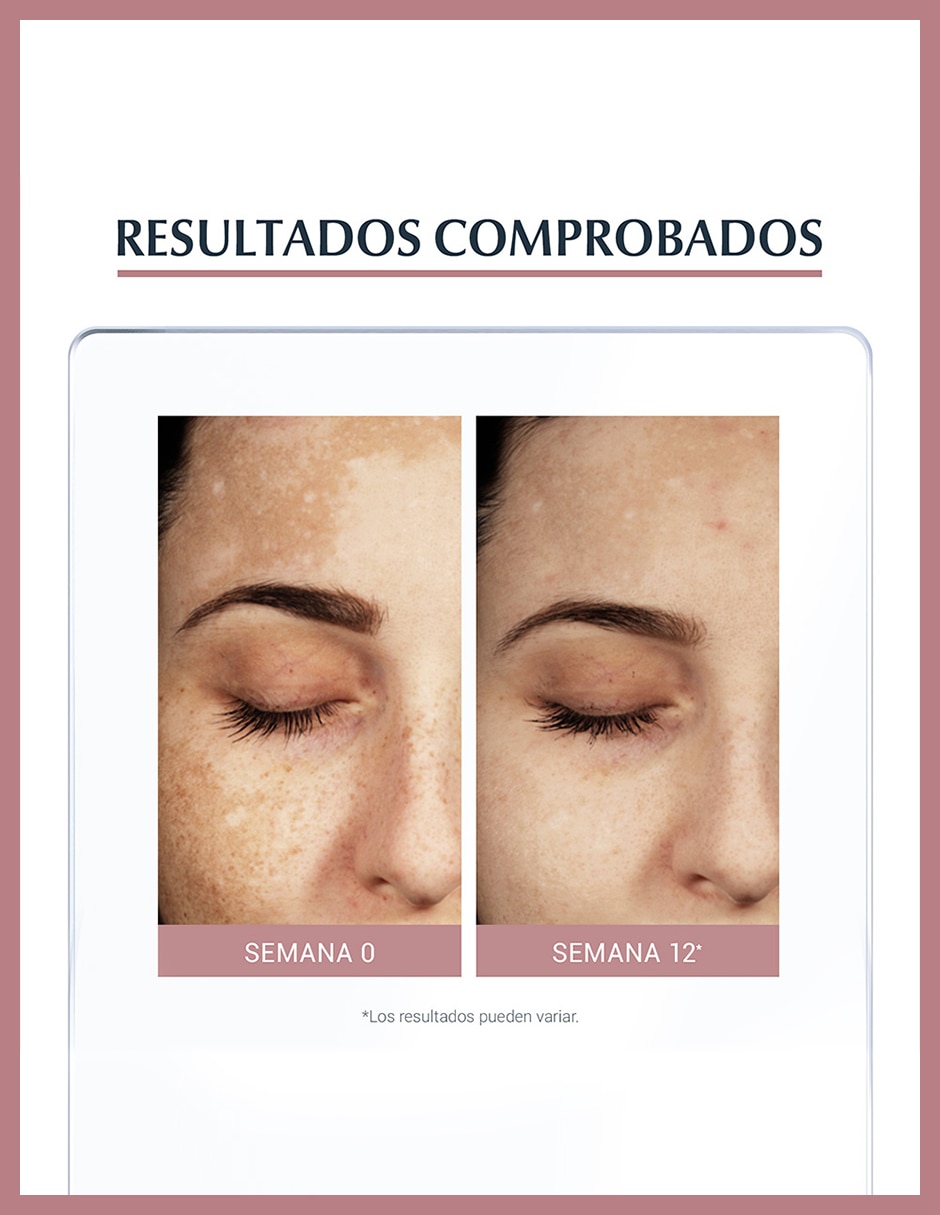 Crema facial recomendada para reducir manchas de día y noche para todo tipo piel 8