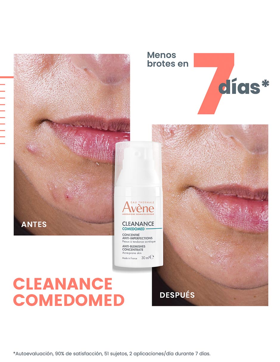 Crema facial recomendada para acné de día y noche Comedomed para piel grasa