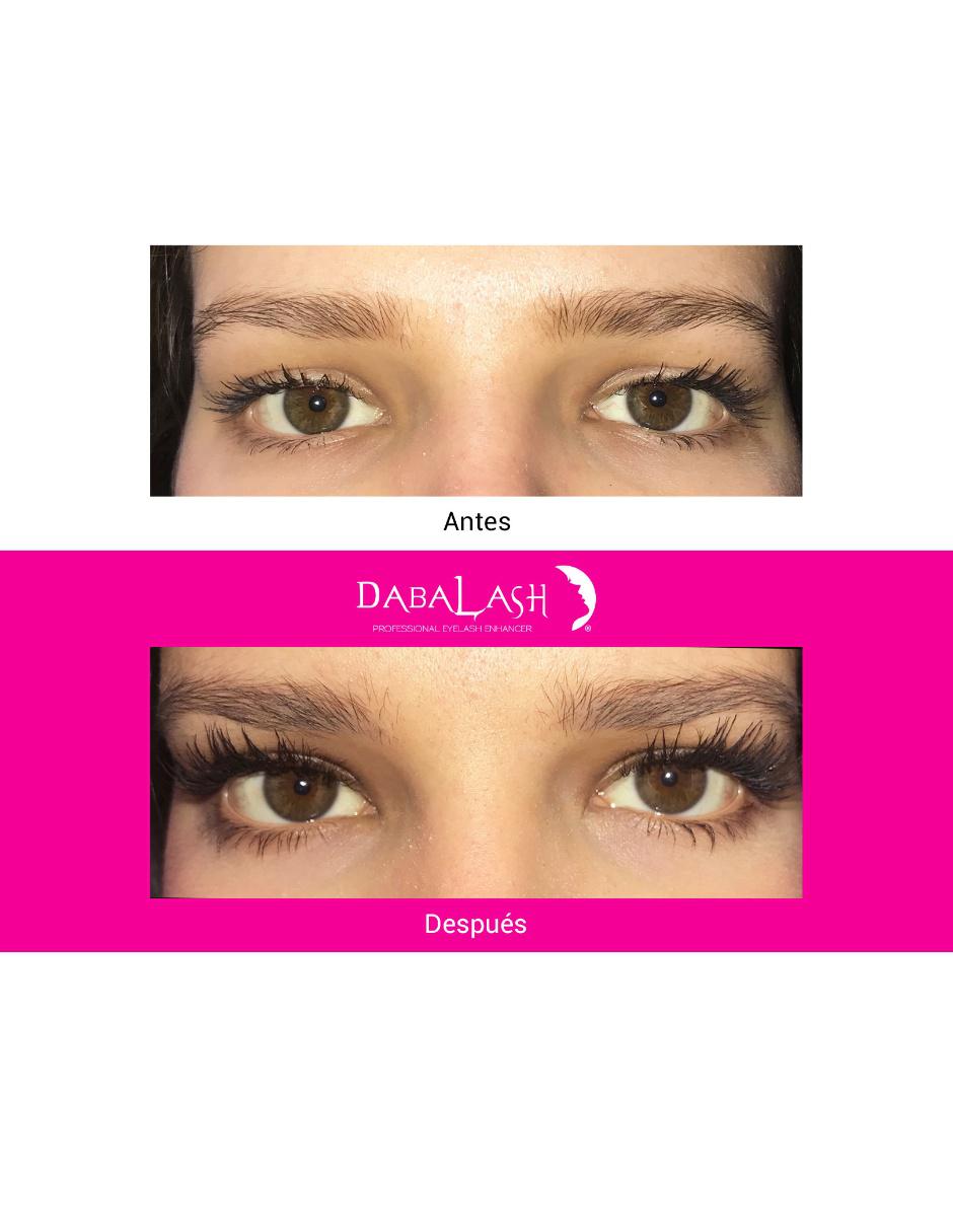 Tratamiento para ojos Combo Suero 3