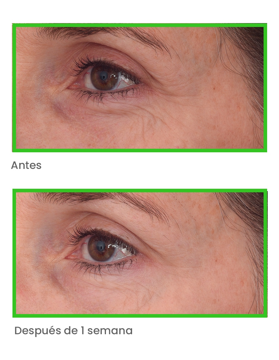 Crema para contorno de ojos recomendada para bolsas y ojeras día y noche - Retinal Resculpt Eye Treatment - Tratamiento Intensivo Antiedad Para Ojos 15Ml Murad todo tipo piel 6