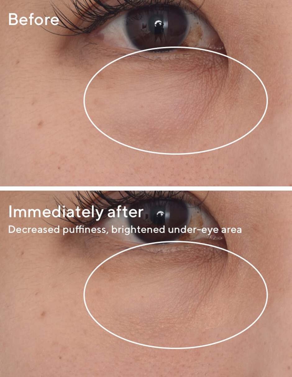 Tratamiento para ojos antiojeras Blemish 7