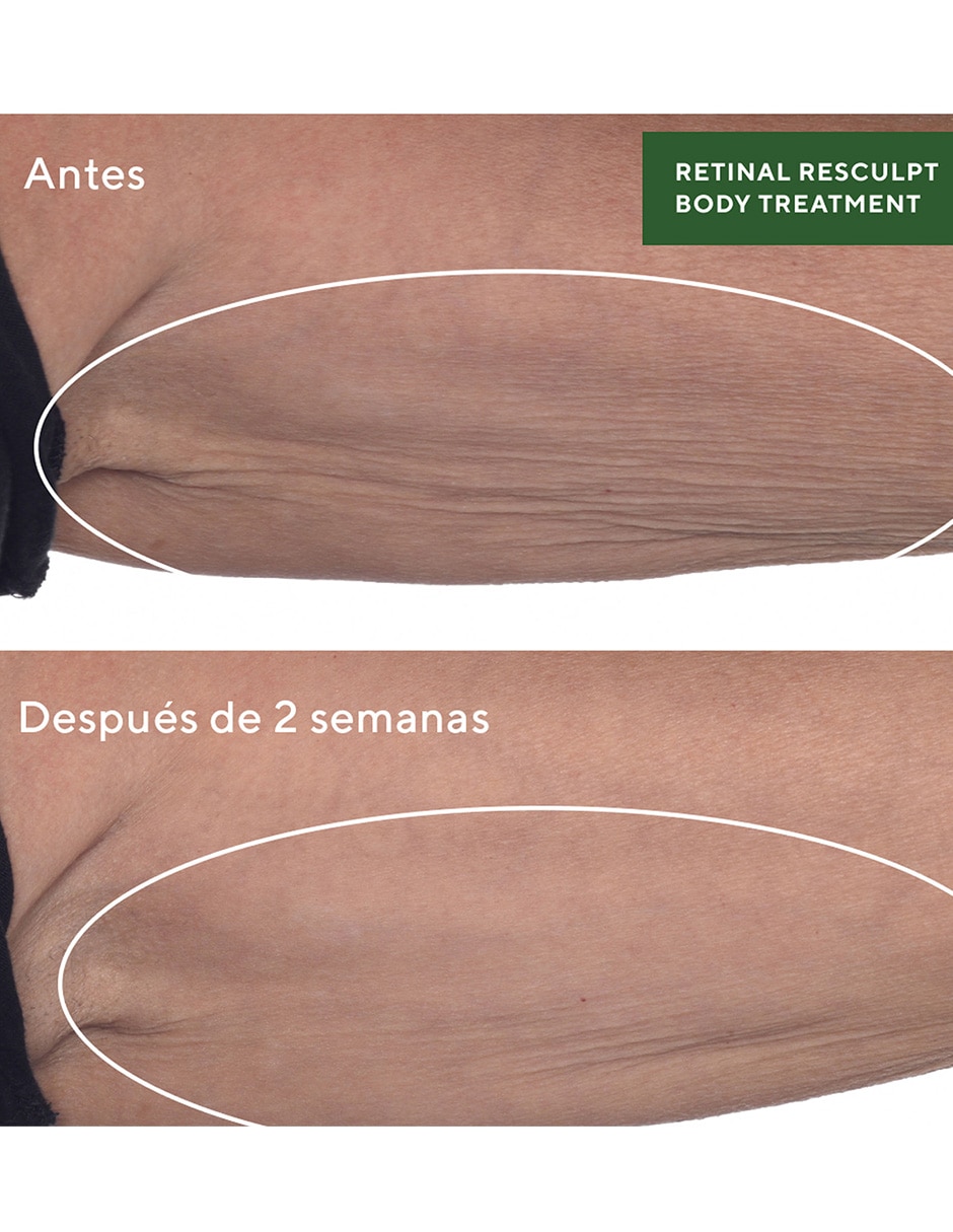 Tratamiento corporal reafirmante antiedad Resurgence 10