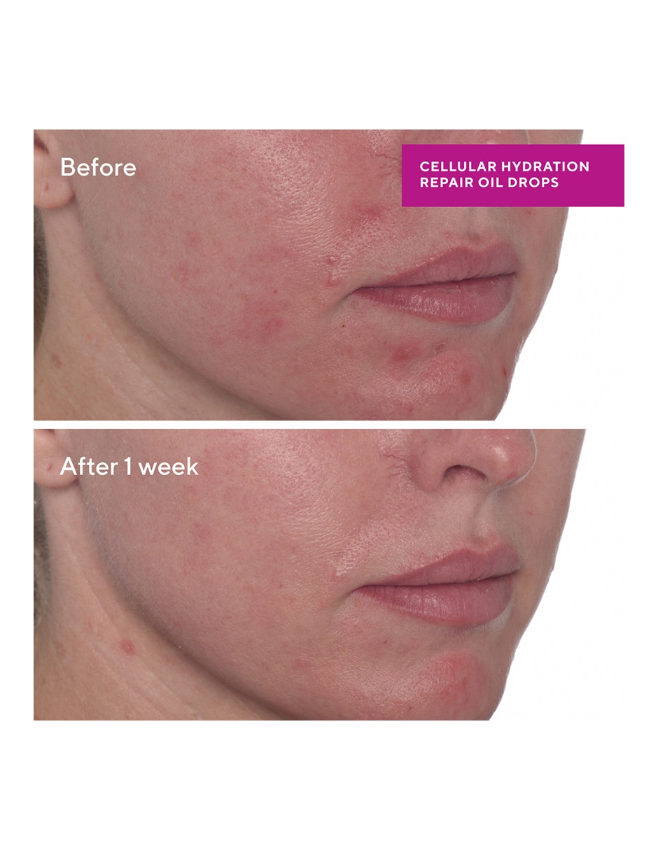 Tratamiento facial Cellular Hydration Repair Oil Drops 9