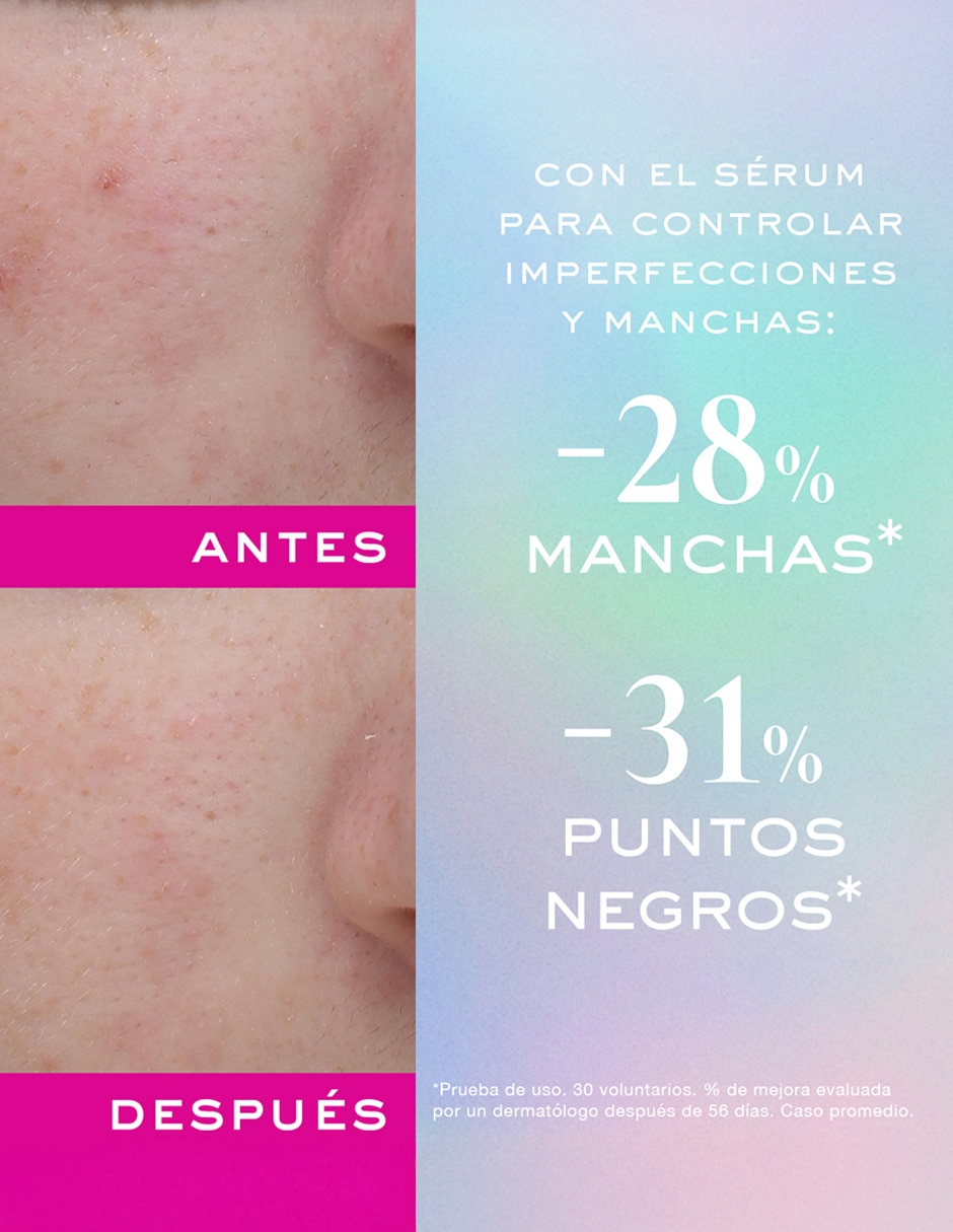 Sérum hidratante facial Anti-Imperfecciones y Anti-Granos Nuxe Zinc Power todo tipo piel