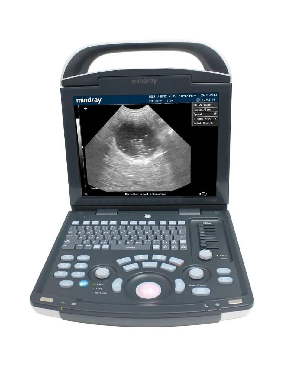 Equipo médico con 3 piezas