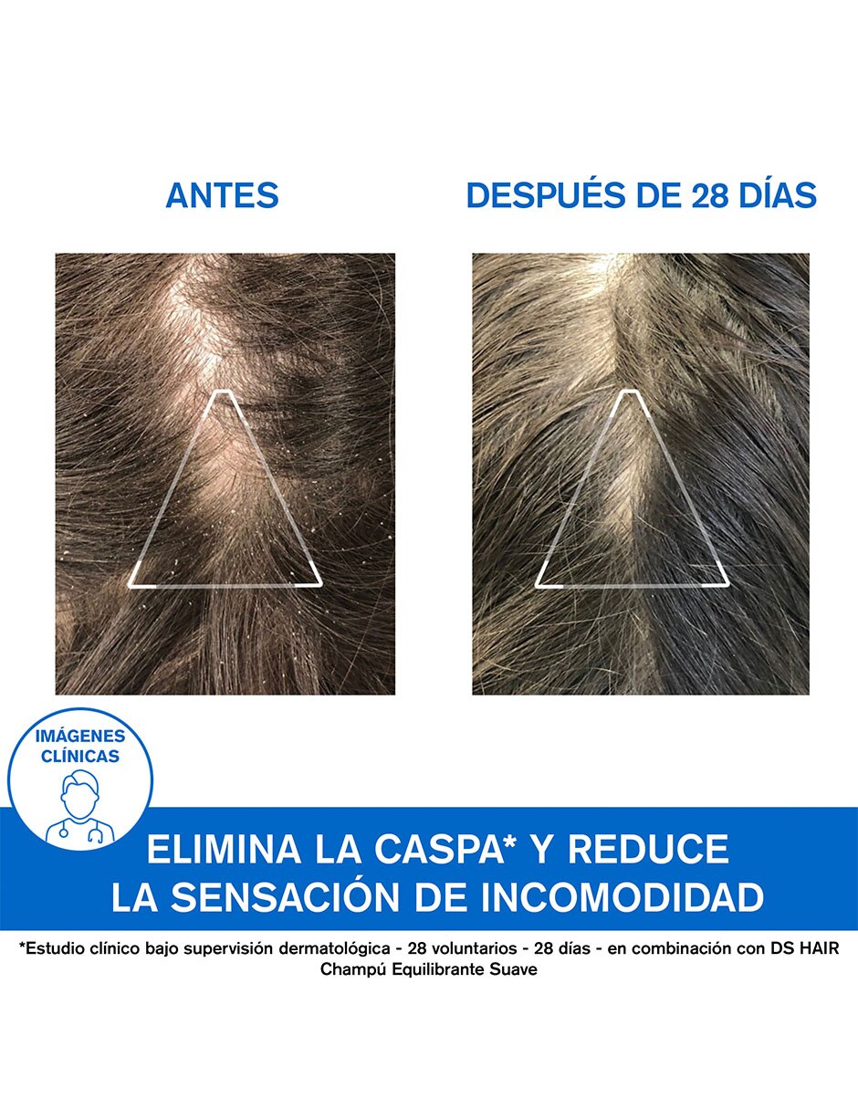 Shampoo anticaspa D.S. 200 ml 8