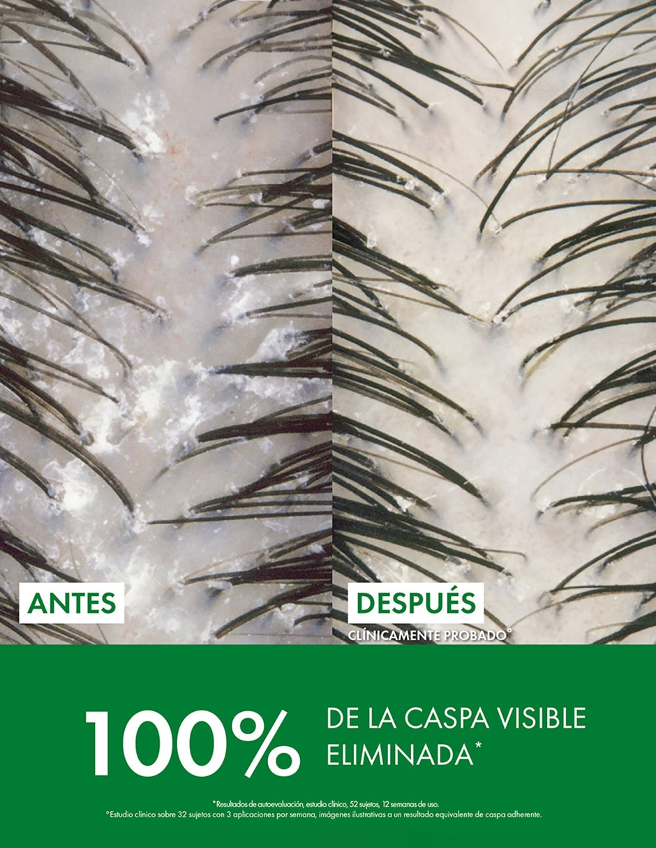 Shampoo anticaspa para cabello Dercos 95 ml 10