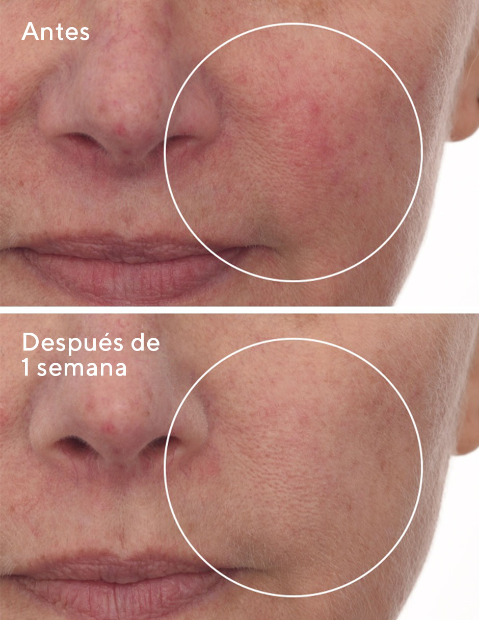 Sérum hidratante facial cellular hydration repair Murad Hydration todo tipo de piel 4