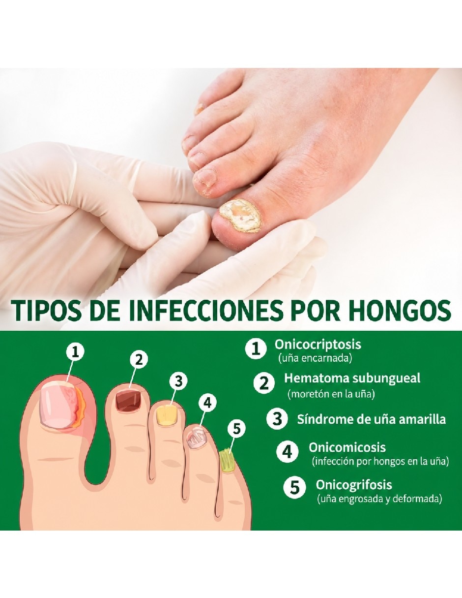 Antimicóticos 4