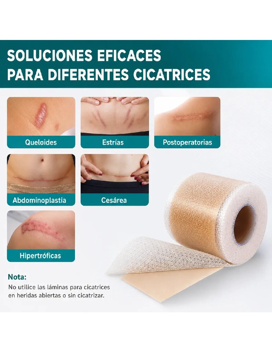Parches para rostro Rollo de parche cicatricial silicona 4